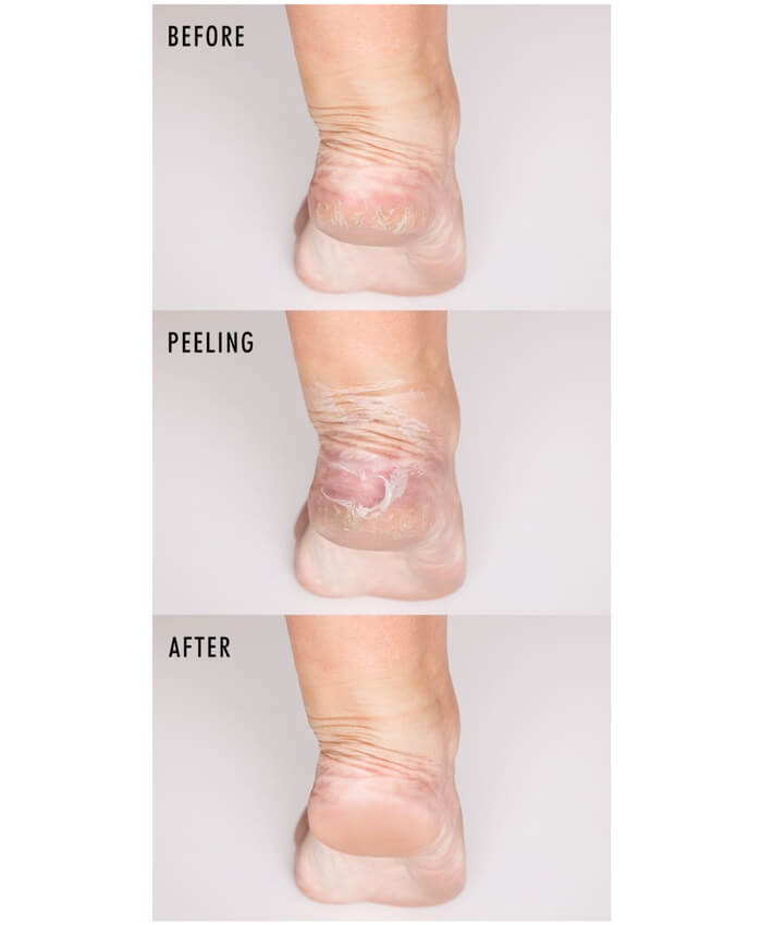 INSTANT PEDICURE FOOT MASK